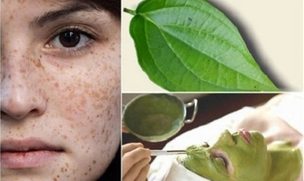 Trị tàn nhang bằng lá trầu không và nước cốt chanh